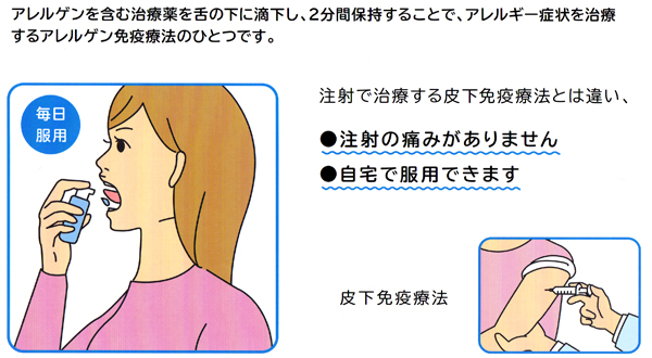 スギ花粉症舌下免疫療法