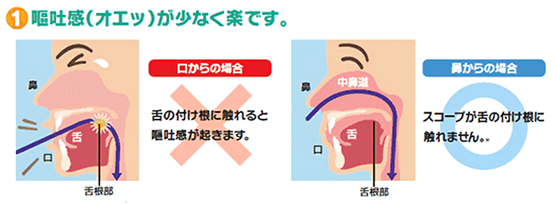検査画像