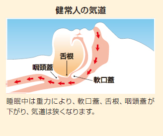 SAS画像