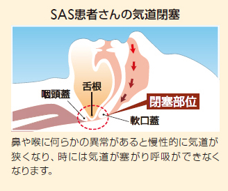 SAS画像