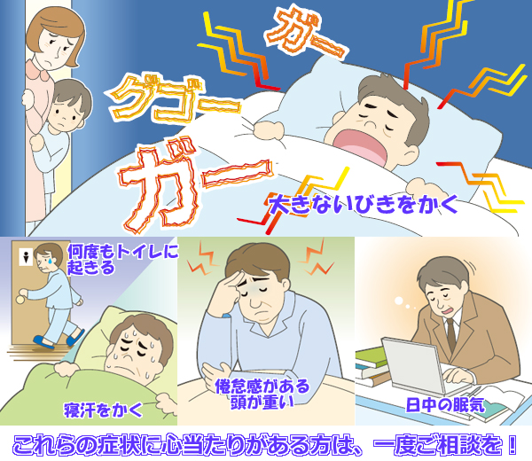 SAS画像