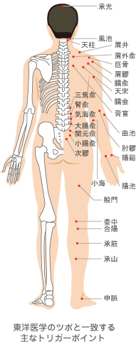 トリガーポイント注射